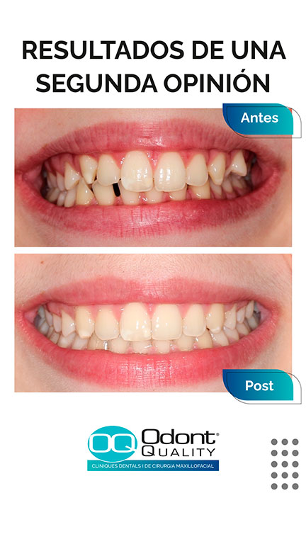 Opinión de Clínica Dental Baruco: Experiencia Real y Resultados